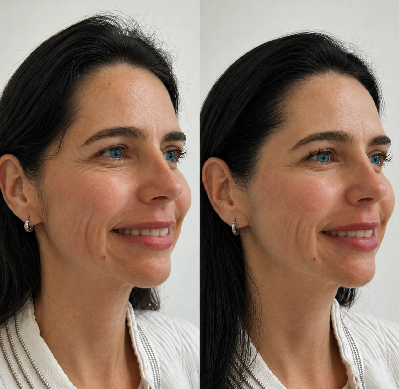 Resultado antes e depois 11